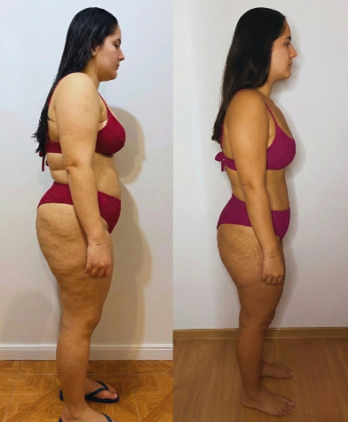 Antes y después perfil